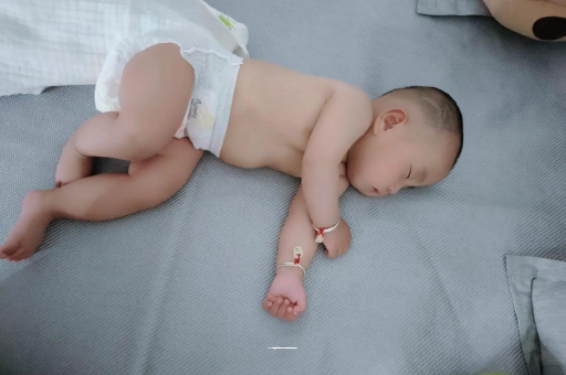 玉林六个月宝宝眼睛散光